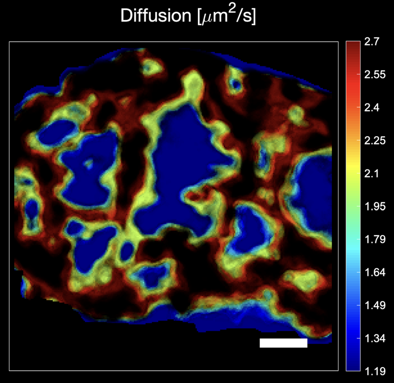 New software from UHasselt and ZEISS shows in sharp detail how biomolecules move in cells.