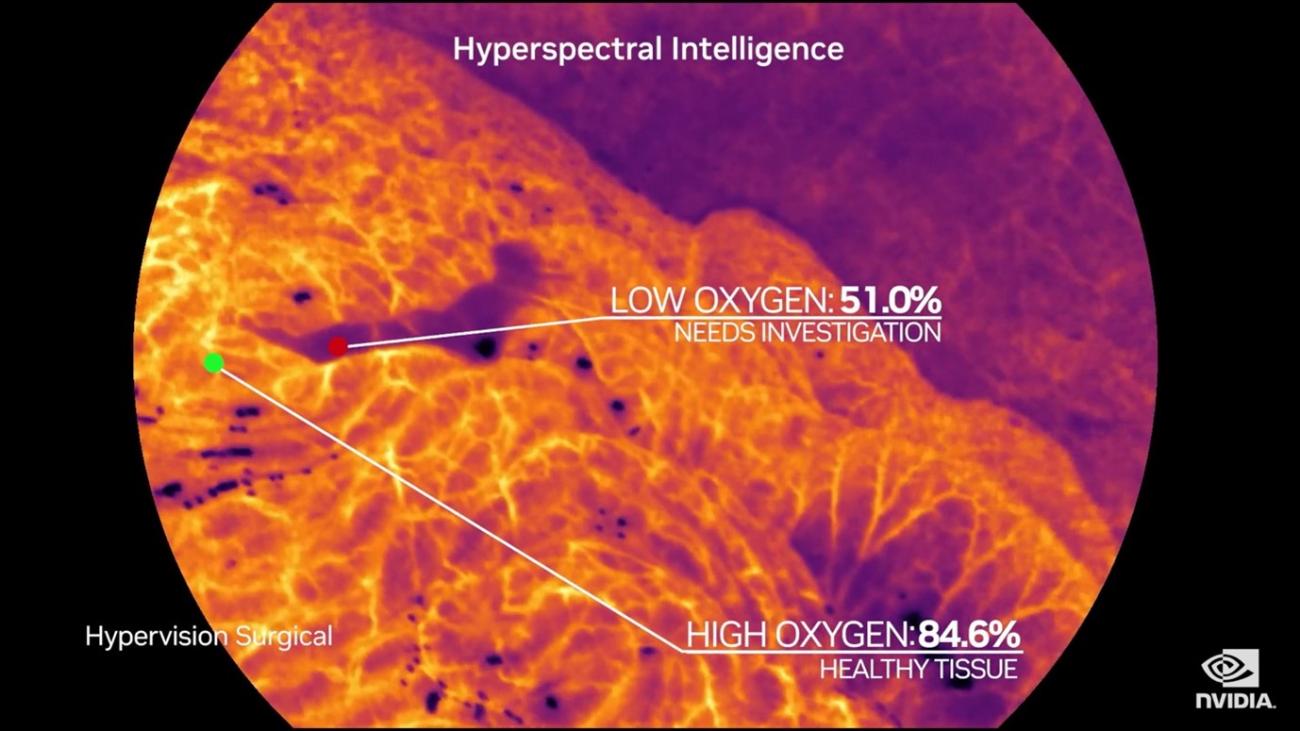 HERAN Partners co-leads the GBP 6,5m financing round of Hypervision Surgical to support the further development and commercial roll-out of their Hyperspectral Imaging platform