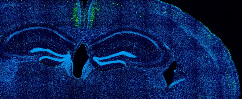 Chicken regulatory DNA sequence activating gene expression in mouse brain neurons, as predicted by the deep learning models