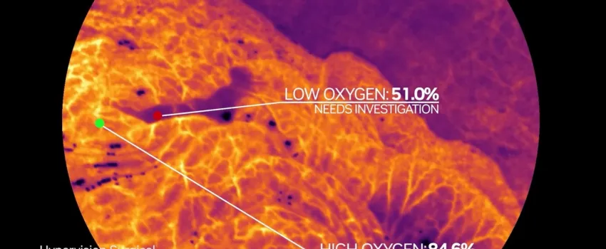 HERAN Partners co-leads the GBP 6,5m financing round of Hypervision Surgical to support the further development and commercial roll-out of their Hyperspectral Imaging platform